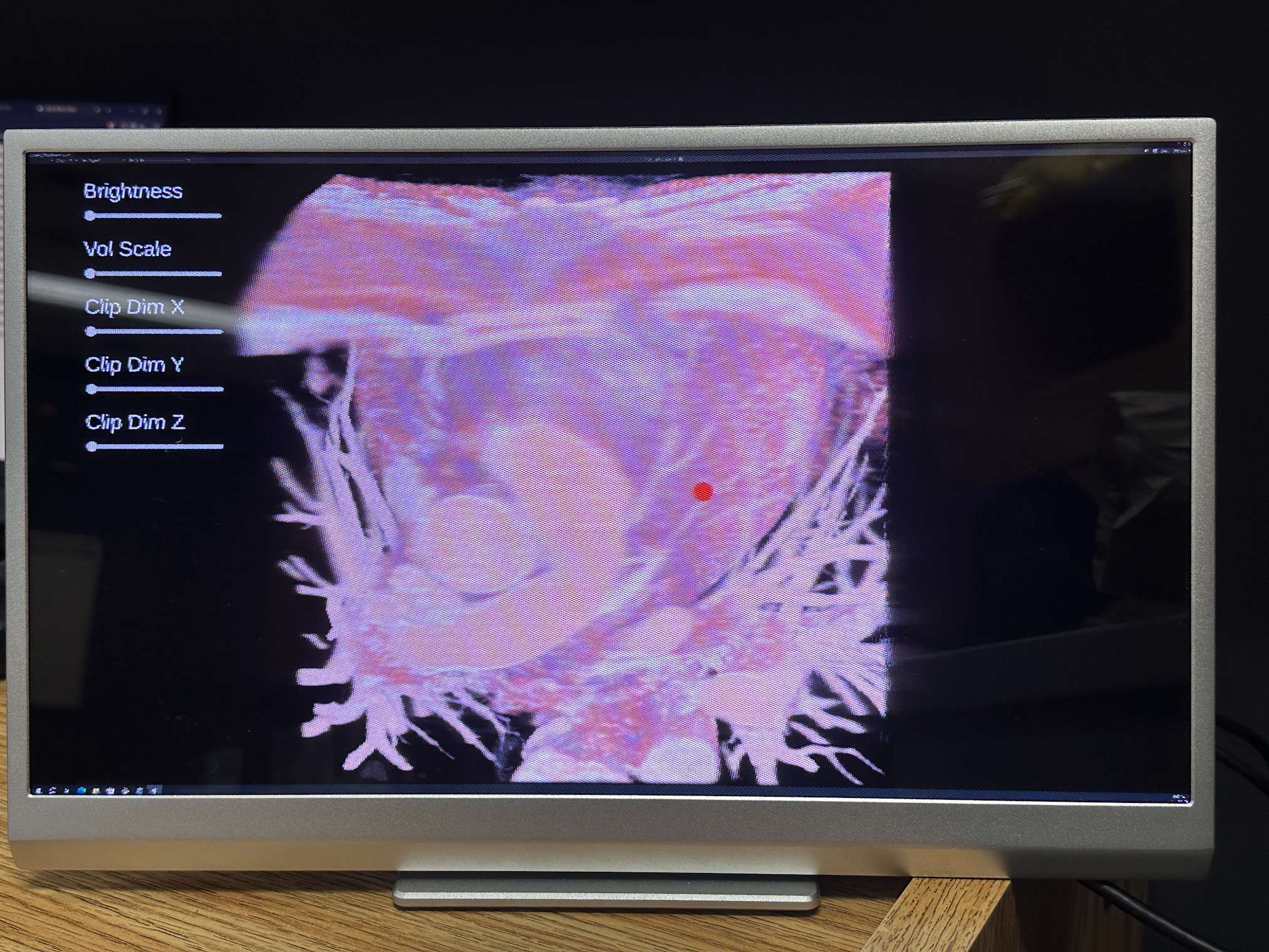 Volumetric medical imaging prototype displayed on Looking Glass holographic hardware